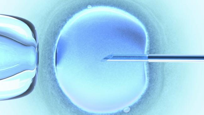 Generic image of an IVF needle in female egg.