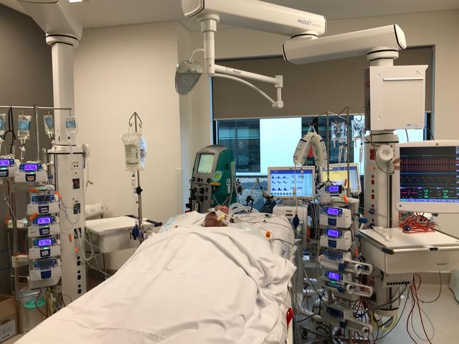 Jason 'Buddy' Miller, 48, of Queenscliff, was attacked to multiple machines in a bid to save his life. Pictured in ICU at Northern Beaches Hospital. Picture: Supplied.