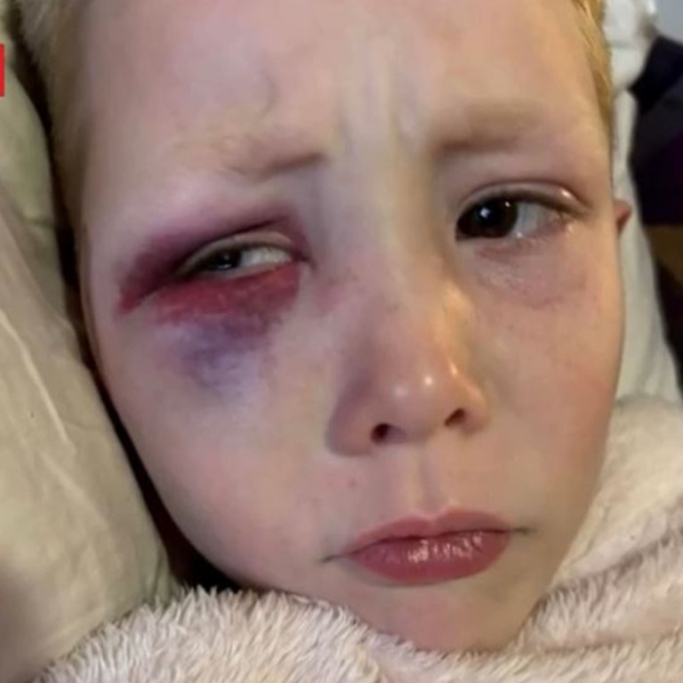 William Brooks-Chiplin had been playing in the front yard of a friend’s house in Tamworth last Thursday when a 10-year-old child allegedly attacked him. Picture: 7NEWS