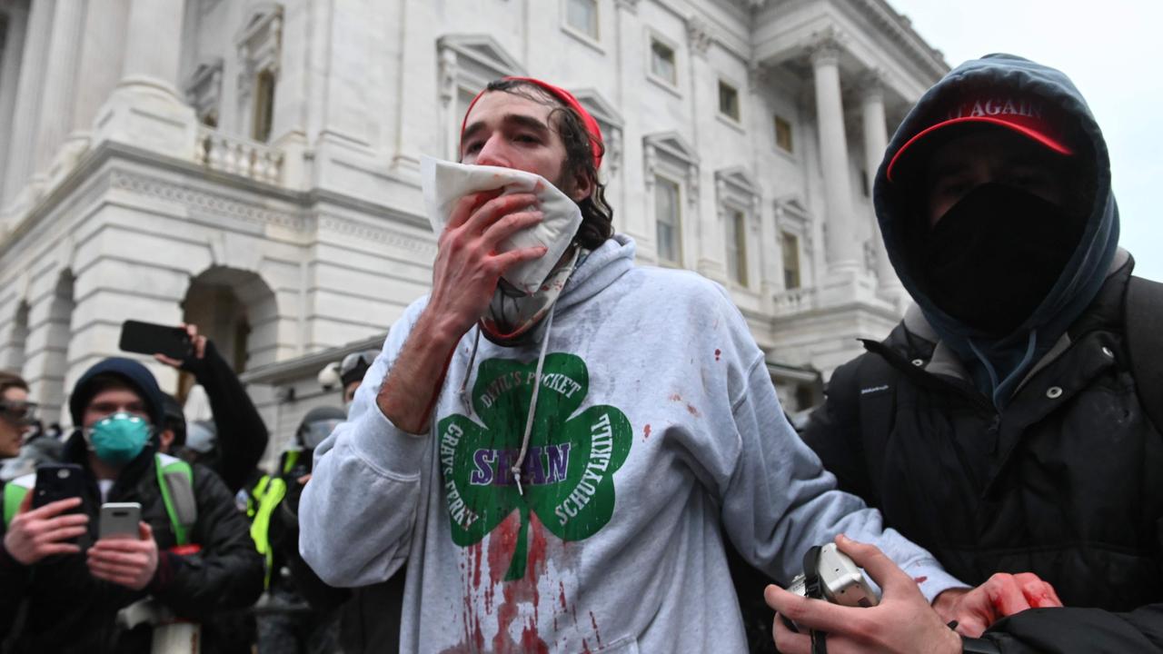 A Trump supporter bleeds from the face after being hit by a projectile during the unrest. Picture: Roberto Schmidt/AFP