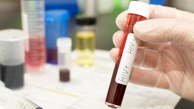 NSW has joined more than 500 global signatories to end the HIV epidemic by 2030. Picture: iStock