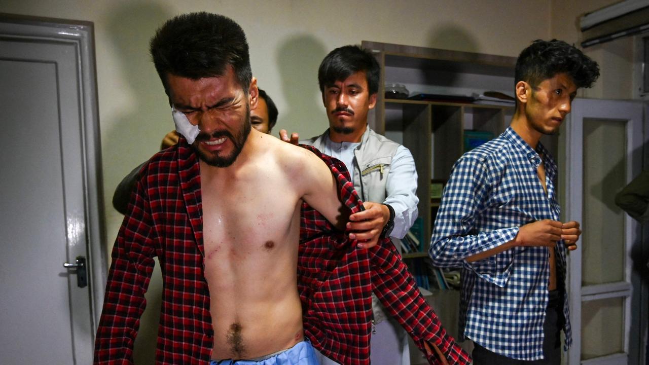 Nematullah Naqdi winces in pain as his colleagues help him put on a shirt after he was beaten by the Taliban. Picture: Wakil Kohsar/AFP