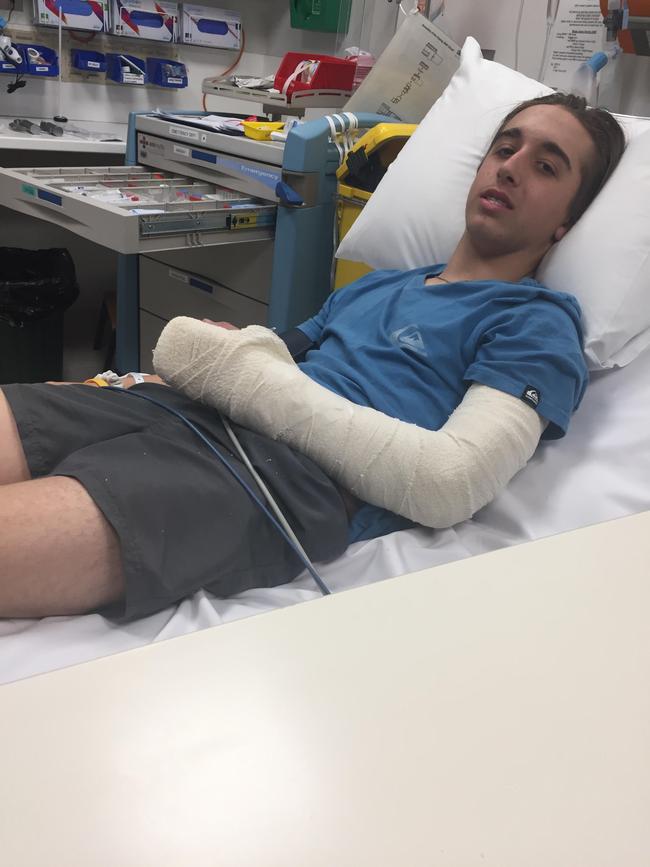 Connor Clark-Mills had to wait six days for surgery on his fractured arm after being told it needed urgent surgery. Picture Supplied