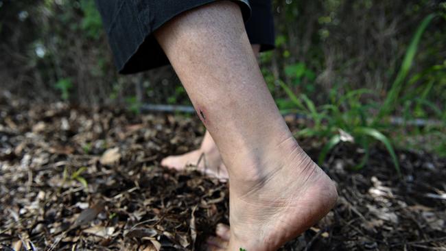 Melioidosis, also known as Nightcliff Gardener's disease, has already claimed three Top End lives this wet season. Picture: Franchi Michael