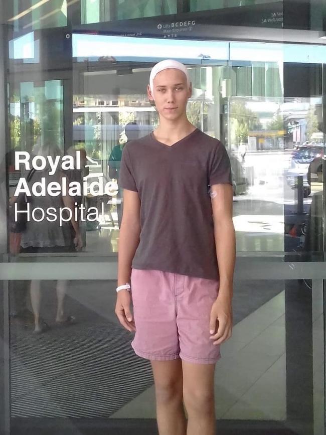 Shane Barker lost 19kg in 20 days after brain surgery at 17. Picture: Supplied