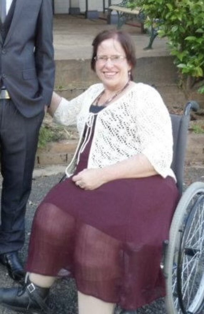 Carol Walker lives her life with an excess fluid build up of seven litres in her legs. Picture – contributed.