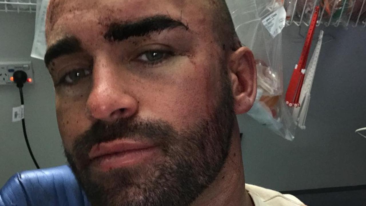 The influencer was taken to St Vincent's Hospital after he was concussed during the brawl. Picture: Instagram