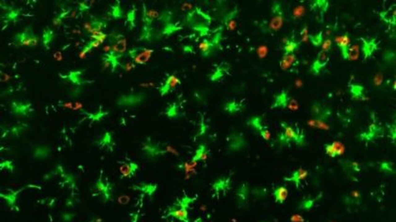 A COVID-19 infected mouse brain from the study showing ‘angry’ microglia in green and SARS-CoV-2 in red. Picture: Supplied