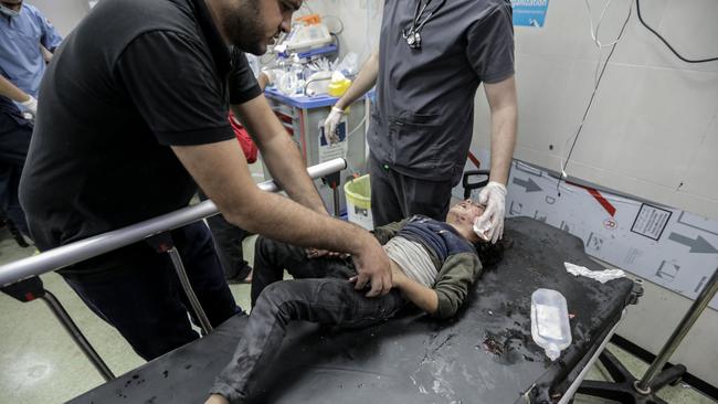 A Palestinian boy injured in Israeli raids is treated at Nasser Hospital in southern Gaza. Picture: Getty Images