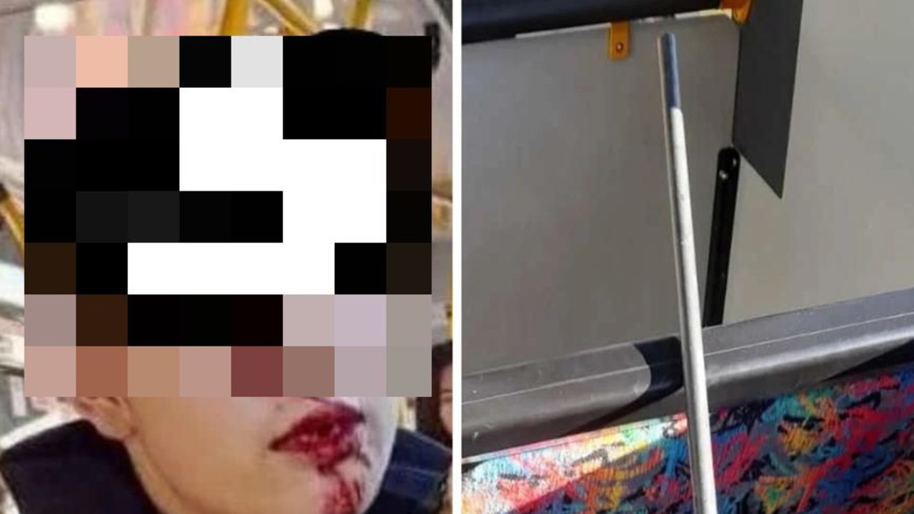 Chinese teen loses teeth in alleged Auckland bus assault by ‘200 kilogram woman’