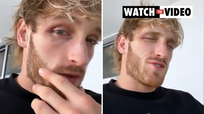 Logan Paul responds after conspiracy erupts over odd moment in fight