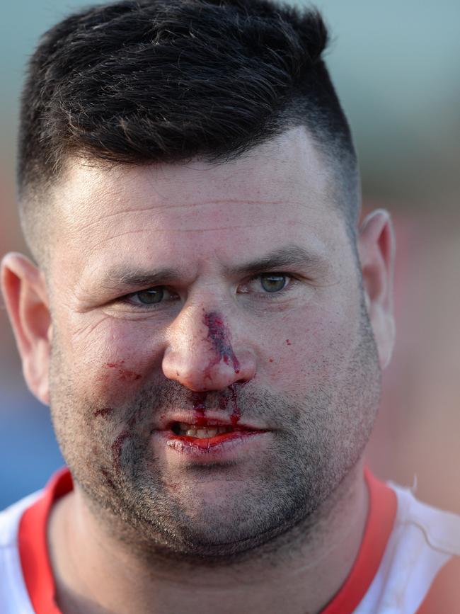 Bloodied Karingal full forward Marc Holt after the final siren.