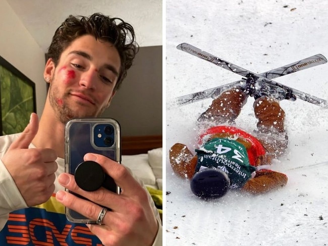 Star knocked out in horror skiing crash