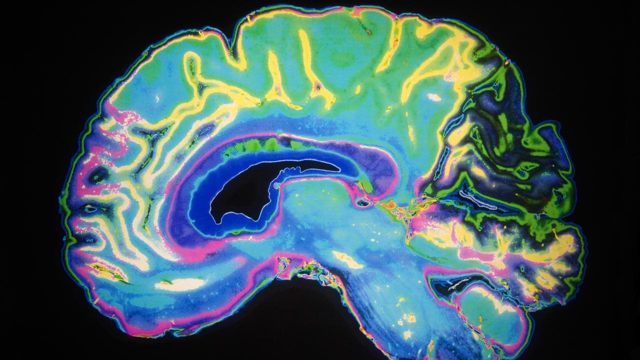 Brain volume impacts ADHD, Parkinson’s: study