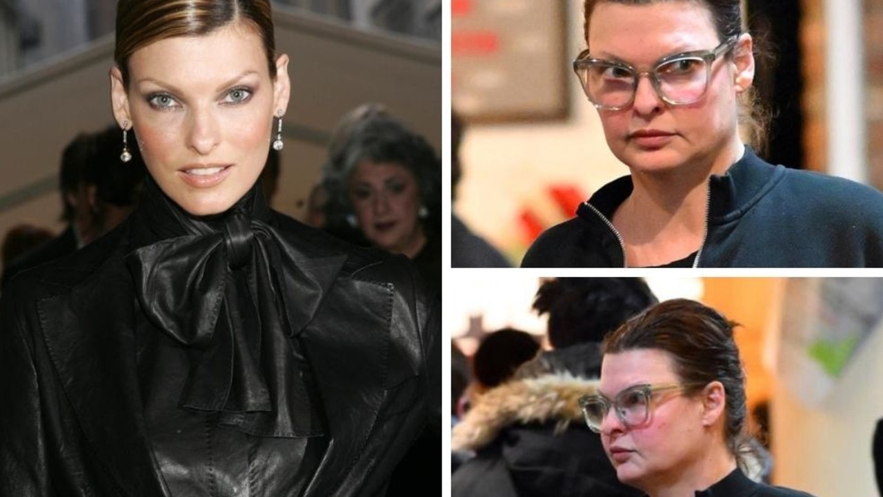 Linda Evangelista unmasks face after ‘botched’ cosmetic surgery | news ...