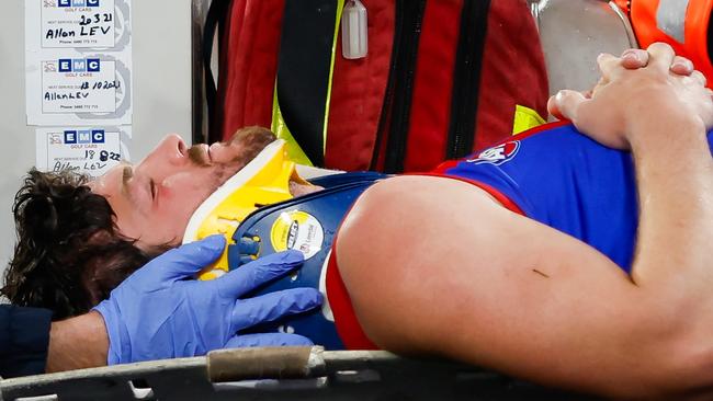 Angus Brayshaw of the Demons leaves the field on a stretcher during the 2023 AFL First Qualifying Final match between the Collingwood Magpies and the Melbourne Demons at Melbourne Cricket Ground on September 07, 2023 in Melbourne, Australia. (Photo by Dylan Burns/AFL Photos via Getty Images)