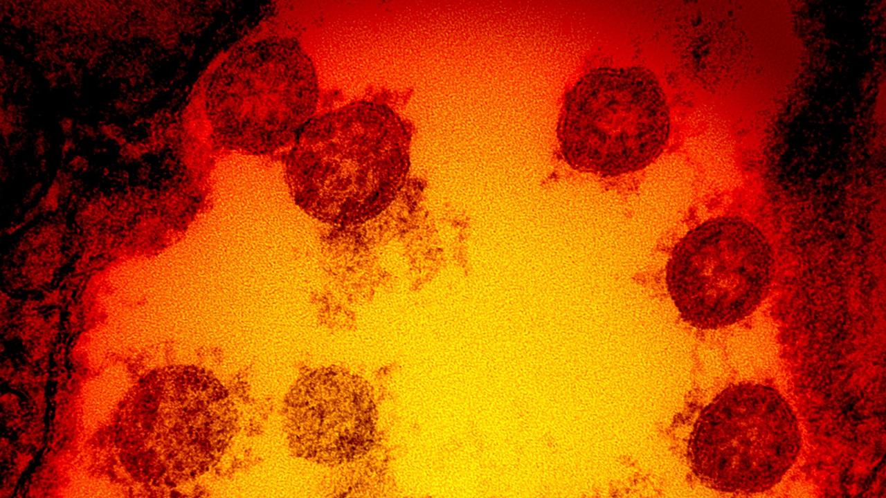 A transmission electron micrograph of SARS-CoV-2 virus particles, isolated from a patient. Picture: AFP