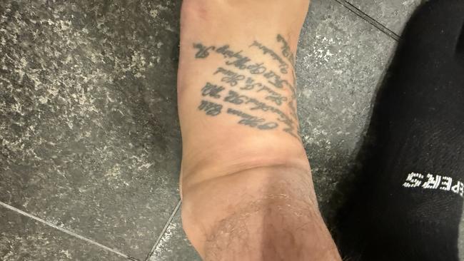 The 41-year-old has been left with permanent damage to his ankle and feet. Picture: Aaron Crook