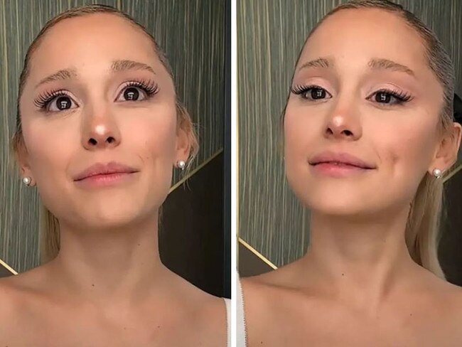 Ariana Grande holds back tears as she admits to getting ‘a ton of lip filler over the years’