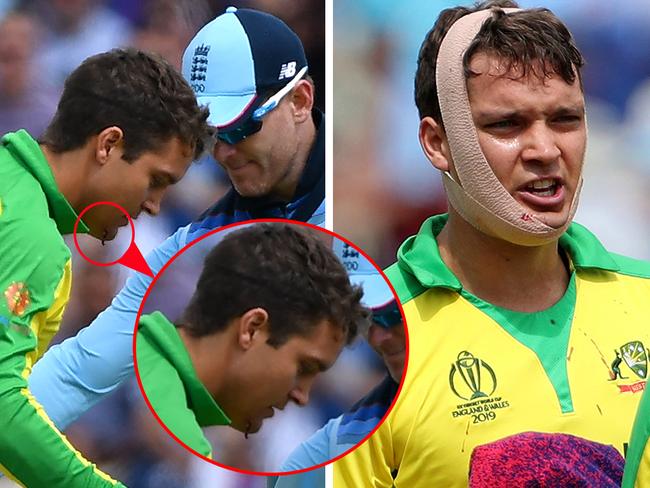 Alex Carey needed stitches after copping a Jofra Archer bouncer in the chin. Pictures: Agencies