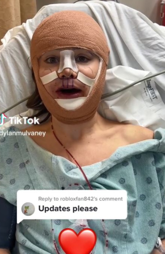 Dylan didn't post much while she recovered. Picture: TikTok