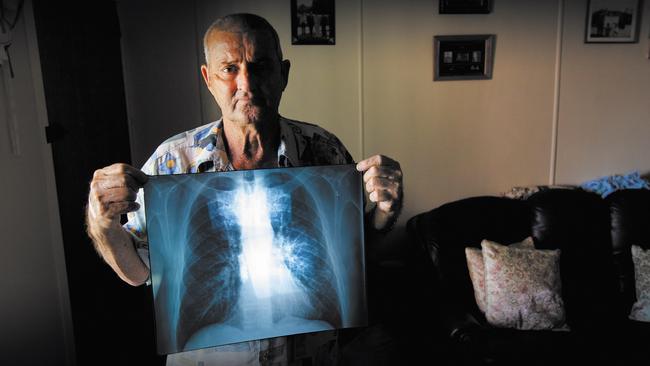 Percy Verrall was diagnosed with black lung disease in 2015. He was the first Australian diagnosed with the disease in 30 years. The latest case — a central Queensland miner — wishes to remain anonymous.