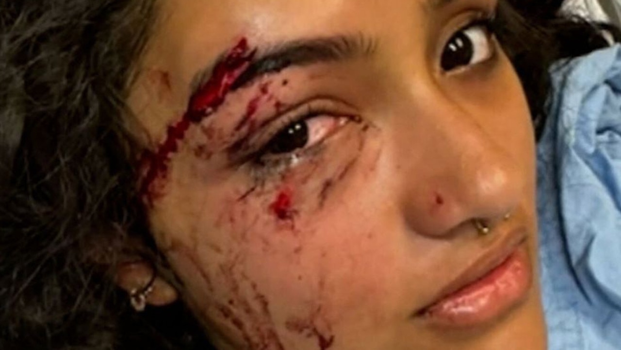 The teenager stepped off the bus when she was allegedly struck by the car. Picture: 9News