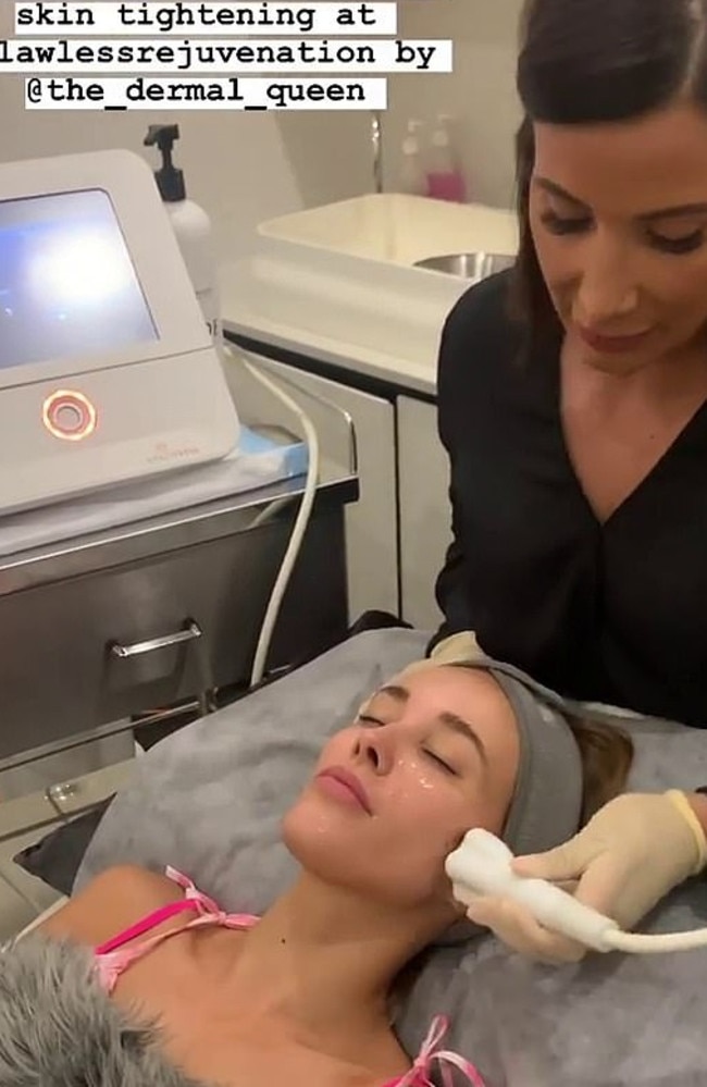 The non-surgical treatment used by Judd uses heat to stimulate the production of collagen. Picture: Instagram/becjudd