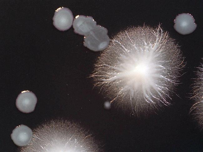 Legionella bacteria at Victorian Infectious Diseases Reference Laboratory 01 May 2000.  legionnaires disease