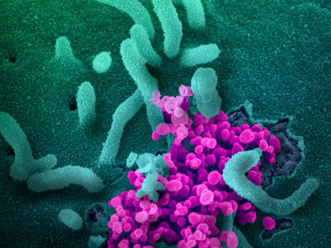 This image obtained March 12, 2020 courtesy of The National Institutes of Health(NIH)/NIAD-RML shows a scanning electron microscope image of SARS-CoV-2 (round magenta objects) emerging from the surface of cells cultured in the lab, SARS-CoV-2, also known as 2019-nCoV, is the virus that causes COVID-19. The virus shown was isolated from a patient in the US. - US President Donald Trump announced a shock 30-day ban on travel from mainland Europe over the coronavirus pandemic that has sparked unprecedented lockdowns, widespread panic and another financial market meltdown March 12, 2020. Trump's unexpected move in a primetime TV address from the Oval Office pummelled stock markets, as traders fretted about the economic impact of the outbreak that is on a seemingly relentless march across the planet. (Photo by Handout / National Institutes of Health / AFP) / RESTRICTED TO EDITORIAL USE - MANDATORY CREDIT "AFP PHOTO /NATIONAL INSTITUTES OF HEALTH/NIAD-RML/HANDOUT " - NO MARKETING - NO ADVERTISING CAMPAIGNS - DISTRIBUTED AS A SERVICE TO CLIENTS