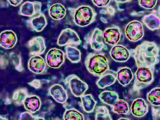 The measles virus, paramyxoviridae from the Morbillivirus family, transmission microscopy view. (Photo by: BSIP/Universal Images Group via Getty Images)