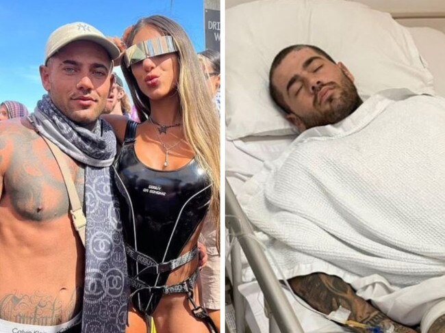 A 24-year-old has been given the difficult ultimatium to save a limb or have it amputated following a head-on motorycle crash in Bali. Picture: Instagram/GoFundMe