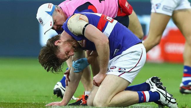 Jordan Roughead’s injury was caused by copping a footy to the face. Picture: Getty