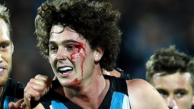 The AFL has been urged to continue to focus on head injuries. Picture: Sam Wundke