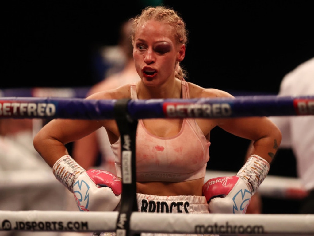 Boxing news: Ebanie Bridges Shannon Courtenay, eye injury, Instagram photos