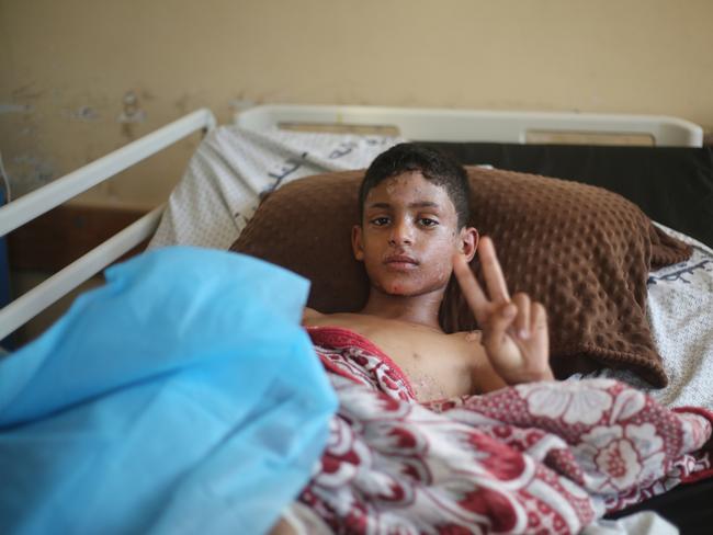 Another injured Palestinian child in an intensive care unit at Nasser Hospital on October 15, 2023 in Khan Yunis, Gaza. Picture: Getty Images