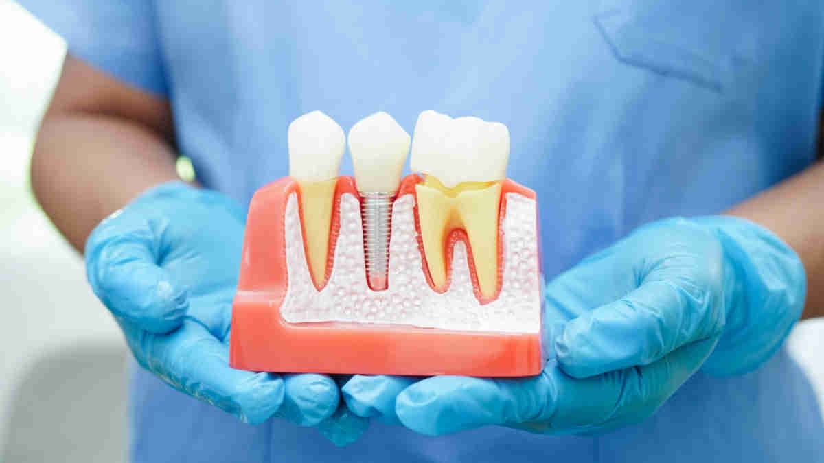 OCC eyes global markets for dental regeneration product. Image: Getty.