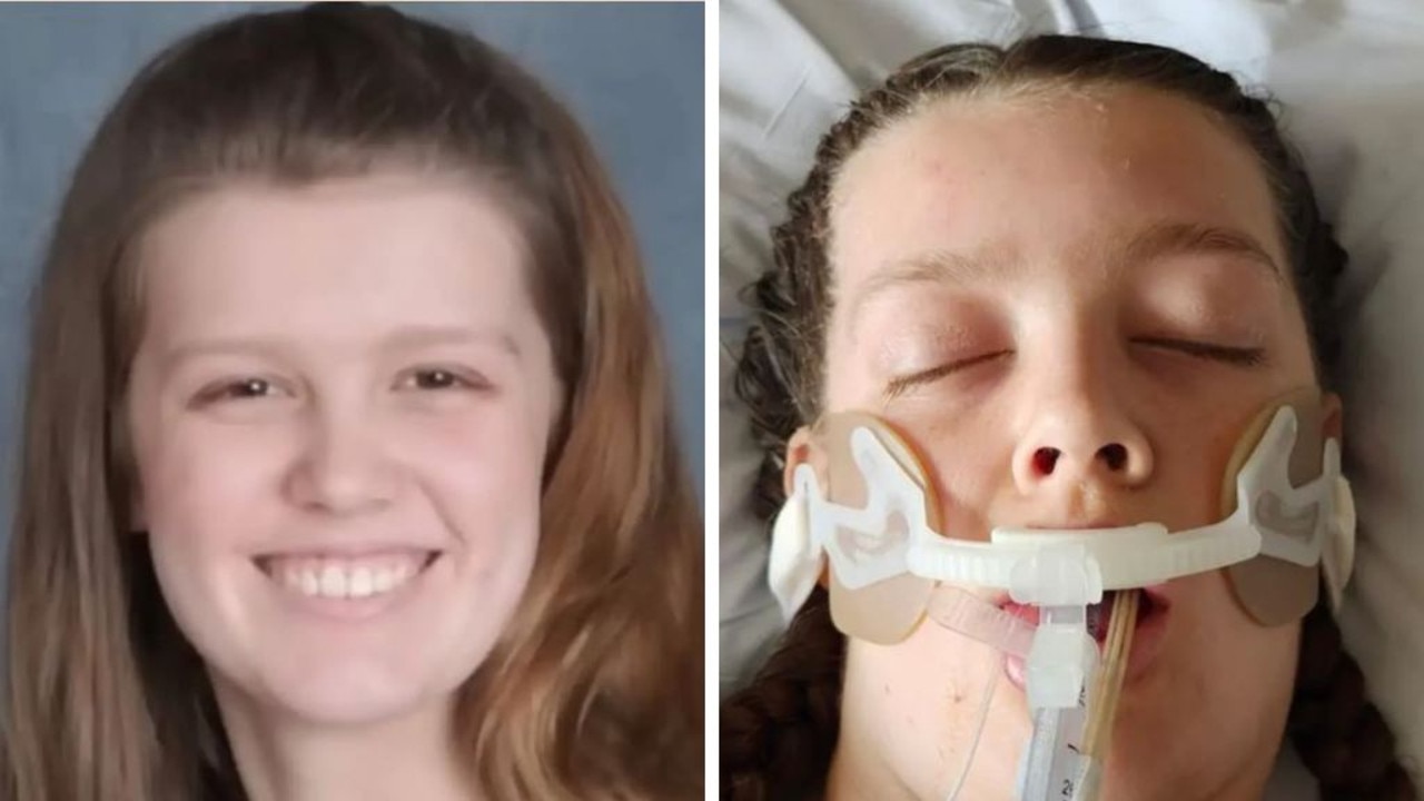 Teenager with severe allergy dead after eating brownie