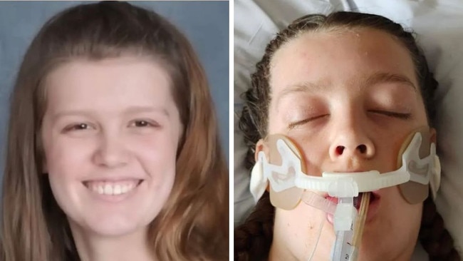 Teen dead after allergic reaction to brownie