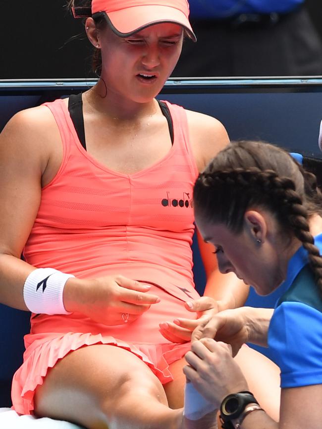 Lauren Davis takes a medical time out to address issues with her right foot. Picture: AAP