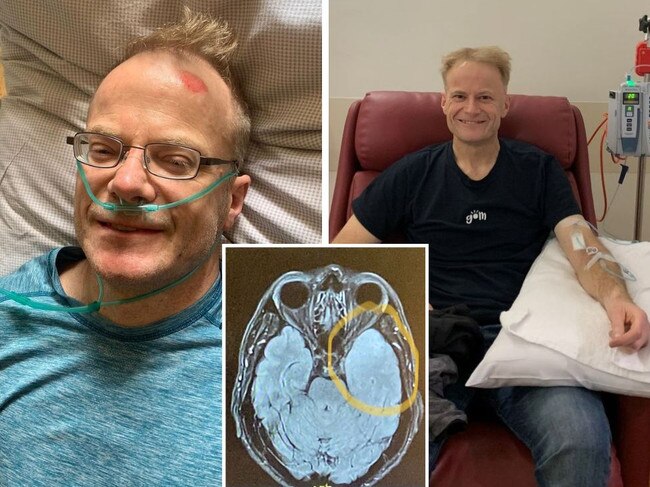 Richard Scolyer is undergoing world first treatment to help treat his cancer. Picture: Instagram.