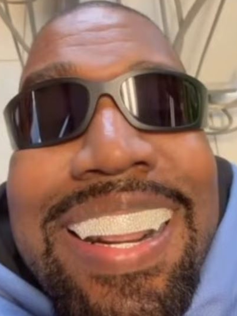 Connelly installed the rapper’s titanium prosthodontics last January, worth a whopping $1.3 million.