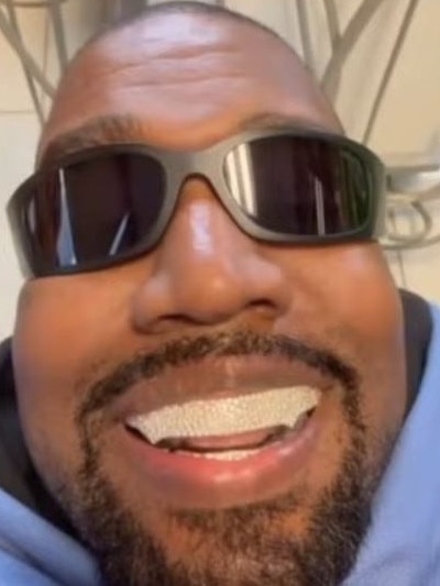 Connelly installed the rapper’s titanium prosthodontics last January, worth a whopping $1.3 million.