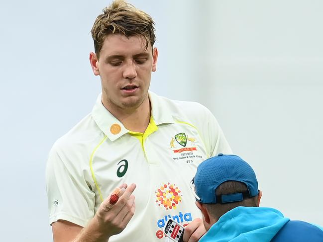 MELBOURNE, AUSTRALIA - DECEMBER 28: Cameron Green of Australia has his finger checked during day three of the Second Test match in the series between Australia and South Africa at Melbourne Cricket Ground on December 28, 2022 in Melbourne, Australia. (Photo by Quinn Rooney/Getty Images)