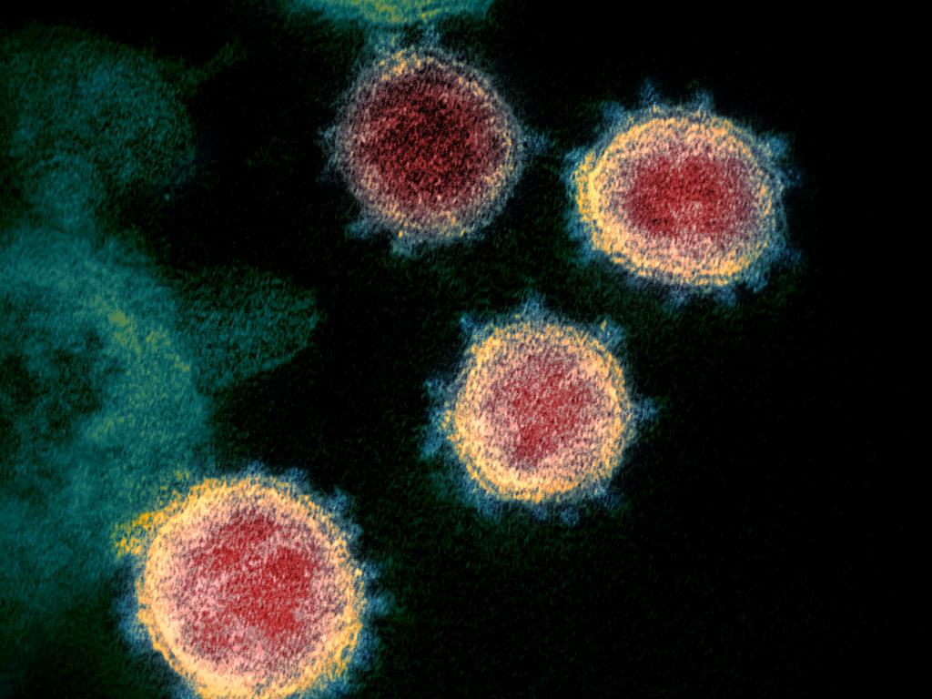 The coronavirus that causes COVID-19 under a microscope. Picture: NIAID-RML via AP.