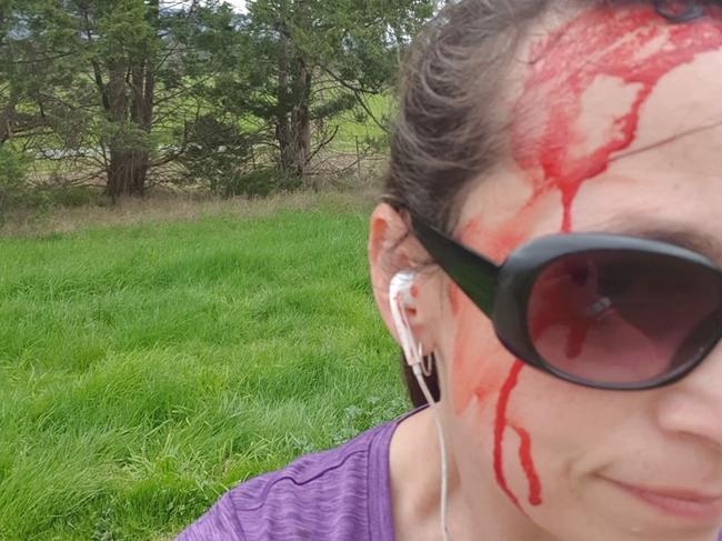 Therese was dive-bombed by a magpie on the Warburton Trail.