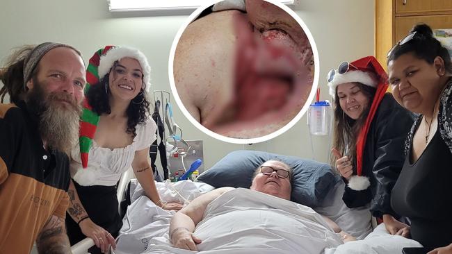 ‘Ringing my children to say goodbye’: Flesh-eating bacteria nearly kills mum