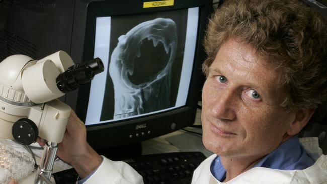 Professer James McCarthy with an image of a hookworm, magnified 500 times.