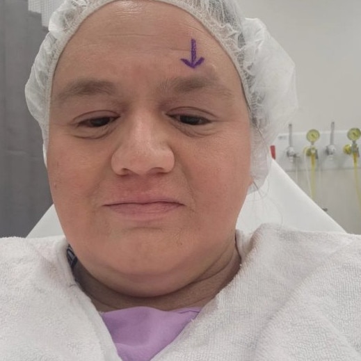 Lisa is completely blind in her left eye and is awaiting surgery to save her remaining vision, which is only at 50 per cent in her right eye. Photo supplied by Lisa Adams