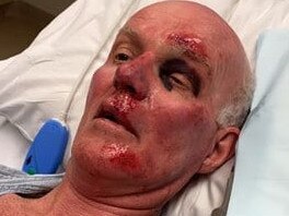 Retiree John DeVries was walking on Brisbane's Jack Pesch Bridge when he was hit by a cyclist from behind on Saturday morning.